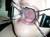 spider gag facial