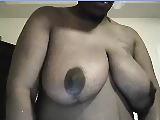 black areola