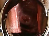 Japanese Extreme EW cervix, speculum, close-up