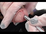 Urethral insertion