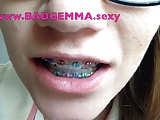 Cum on my braces