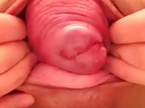 japanese girl close up prolapse pussy 