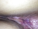 Asshole examination up close anal inspection 