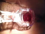 close up pussy & speculum