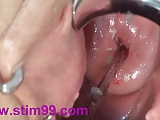 Cervix Fucking Play Deep