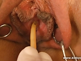 Female sounding and catheter insertion