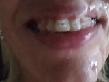 Brace face cum facial