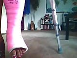 cast fetish - broken ankle