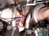 urethra Sounding With E-Stim 