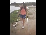 RBK amputee crutching